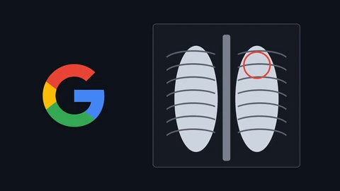 The red, yellow, green and blue Google G beside a simple drawn chest X-ray with a red circle marking the top of one lung, on a dark background.